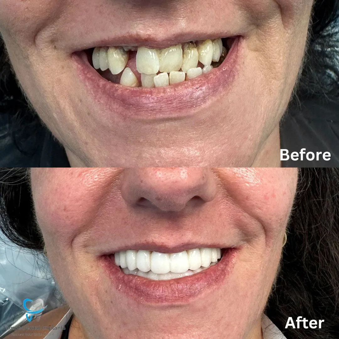 befor-after image