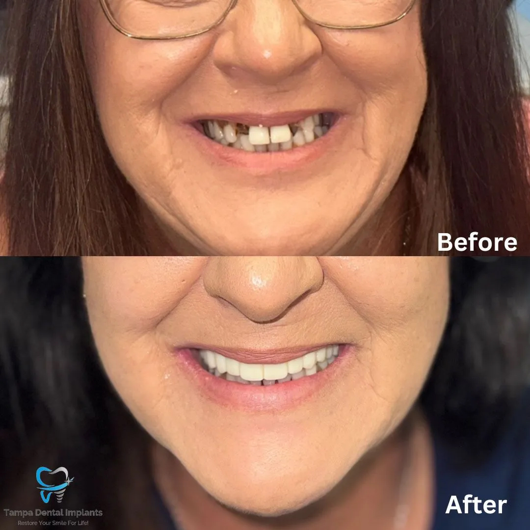 befor-after image