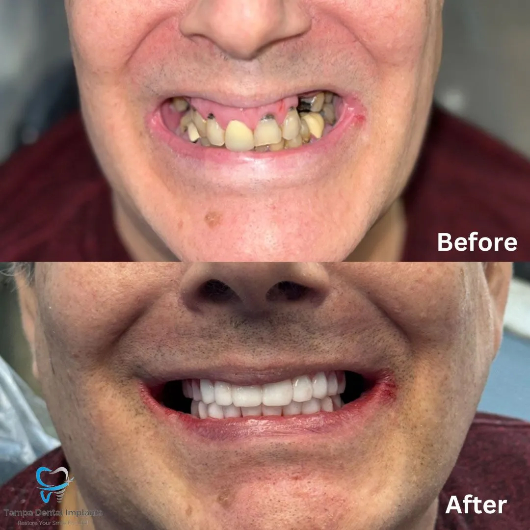 befor-after image